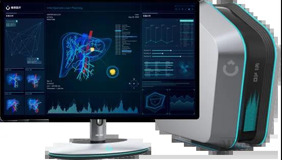 全球首个且唯一ai-4d智能手术规划系统